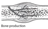 boneheal-production