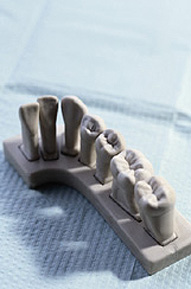 A model of our dental fillings in Valparaiso, IN