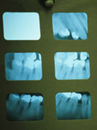 dental radiographs