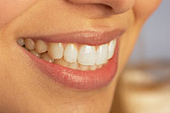 Lasting Smiles after Cosmetic Dentistry