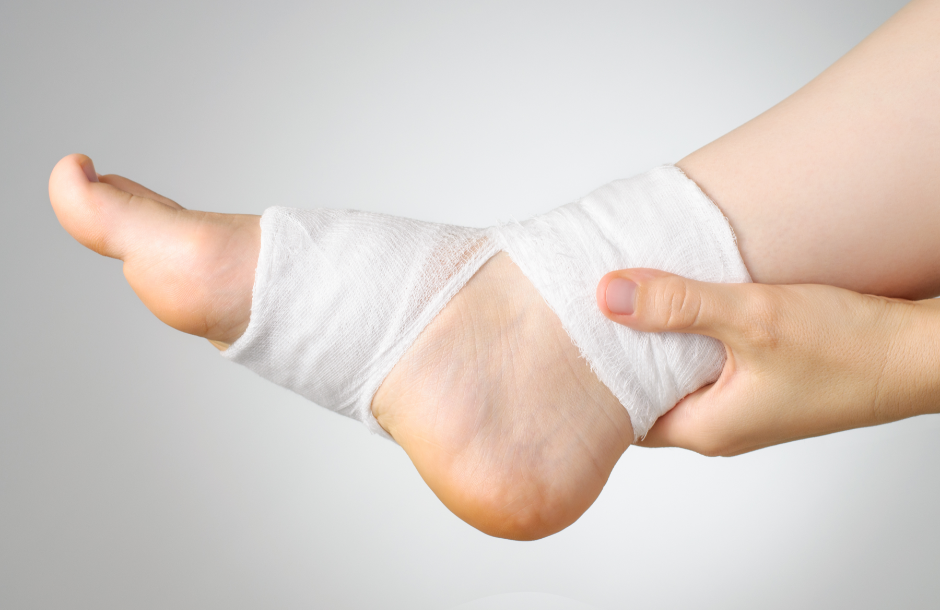A person with a foot bandage for podiatry marketing ideas
